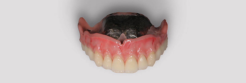歯科技工士　奥森 健史 施術イメージ2