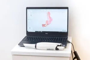 口腔内スキャナー